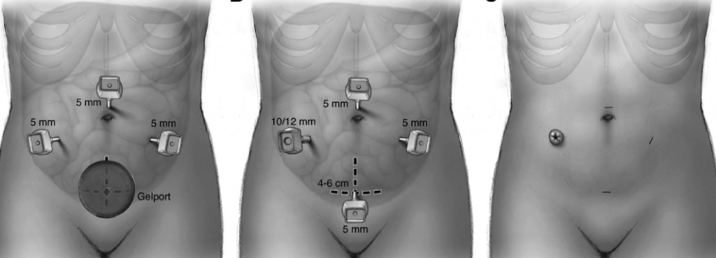 Prieskum  ukázal, ktoré slovenské pracoviská operujú najviac pacientov s&nbsp;IBD.